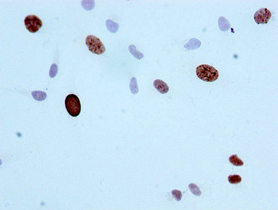 Phospho-Histone H3 (Ser10) Antibody in Immunocytochemistry (ICC/IF)
