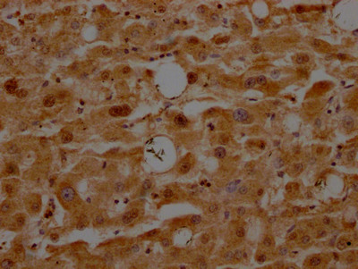 ATF5 Antibody in Immunohistochemistry (Paraffin) (IHC (P))