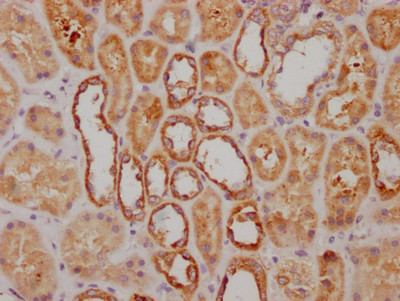 NDUFS3 Antibody in Immunohistochemistry (Paraffin) (IHC (P))