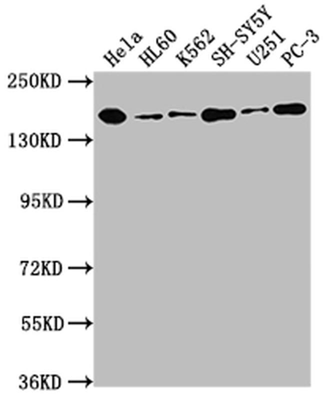 Dot1L Antibody in Western Blot (WB)