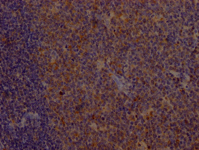 CD80 Antibody in Immunohistochemistry (Paraffin) (IHC (P))