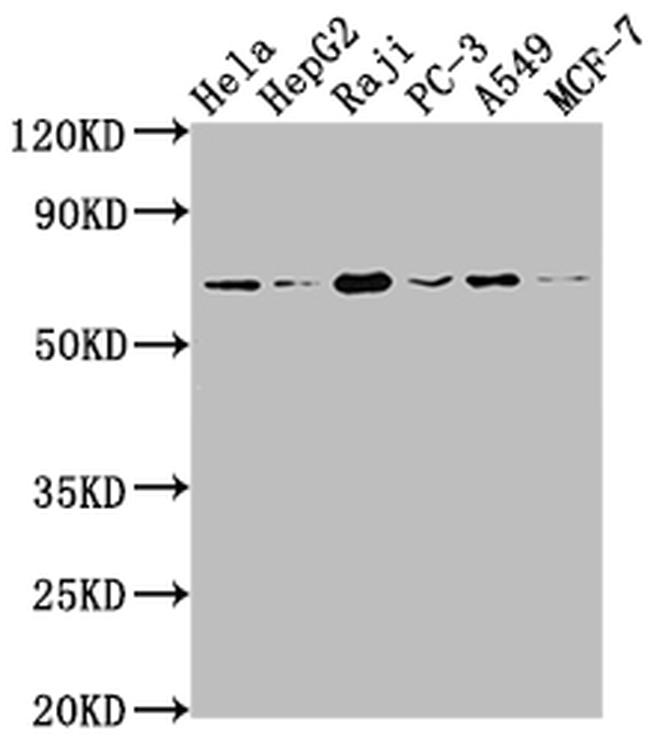 ALAS1 Antibody in Western Blot (WB)