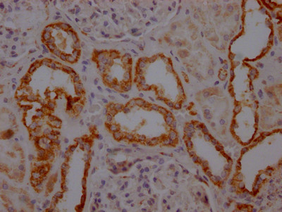 TOMM22 Antibody in Immunohistochemistry (Paraffin) (IHC (P))