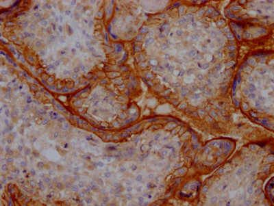 CD51 Antibody in Immunohistochemistry (Paraffin) (IHC (P))