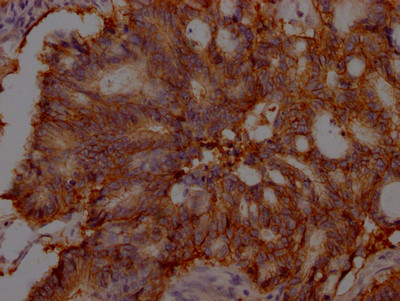 EpCAM Antibody in Immunohistochemistry (Paraffin) (IHC (P))
