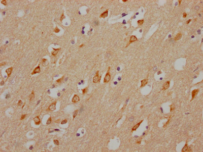 CHRM3 Antibody in Immunohistochemistry (Paraffin) (IHC (P))