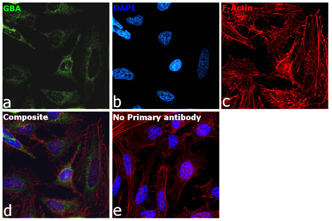 GBA Antibody in Immunocytochemistry (ICC/IF)