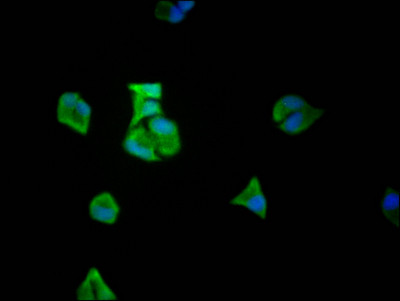 eIF5A Antibody in Immunocytochemistry (ICC/IF)