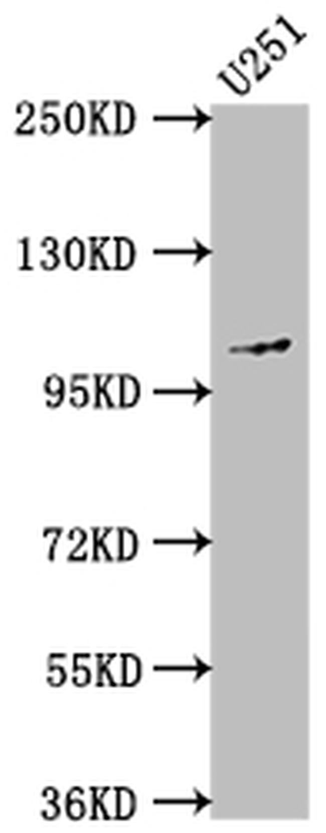CD10 Antibody in Western Blot (WB)