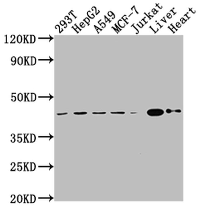 AGTR2 Antibody in Western Blot (WB)