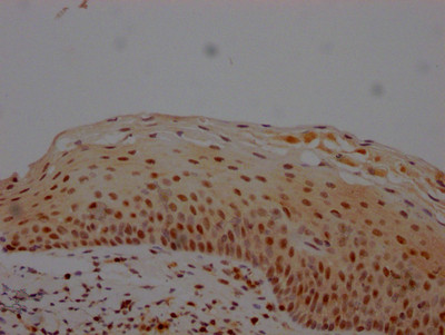MGMT Antibody in Immunohistochemistry (Paraffin) (IHC (P))