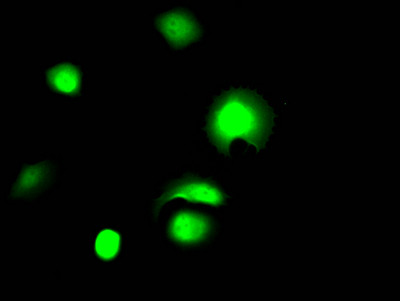 Galectin 3 Antibody in Immunocytochemistry (ICC/IF)
