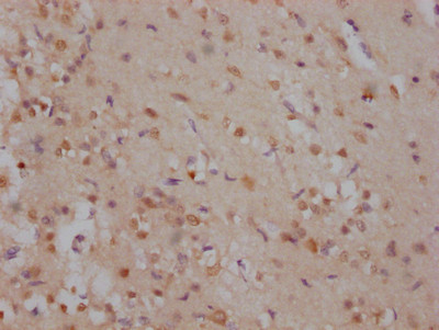 SOX2 Antibody in Immunohistochemistry (Paraffin) (IHC (P))