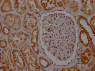 SDHB Antibody in Immunohistochemistry (Paraffin) (IHC (P))
