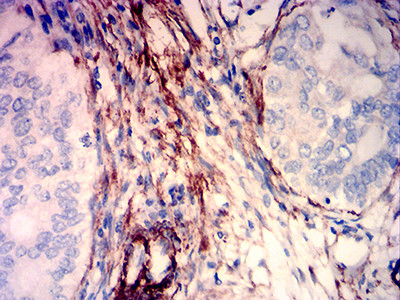 Caldesmon Antibody in Immunohistochemistry (Paraffin) (IHC (P))