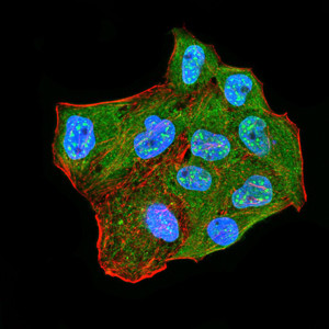 CBX2 Antibody in Immunocytochemistry (ICC/IF)