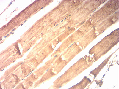 Creatine Kinase MM Antibody in Immunohistochemistry (Paraffin) (IHC (P))