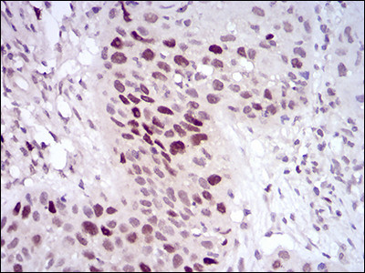 HDAC10 Antibody in Immunohistochemistry (Paraffin) (IHC (P))