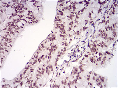 Menin Antibody in Immunohistochemistry (Paraffin) (IHC (P))
