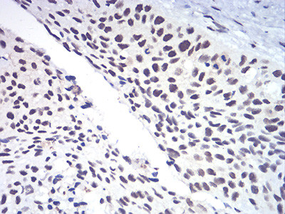 RAD50 Antibody in Immunohistochemistry (Paraffin) (IHC (P))