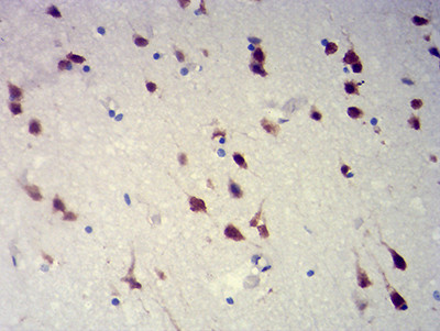 RBFOX2 Antibody in Immunohistochemistry (Paraffin) (IHC (P))