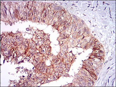 TIE1 Antibody in Immunohistochemistry (Paraffin) (IHC (P))