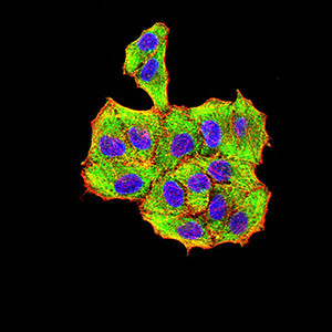Human Parvovirus VP2 Antibody in Immunocytochemistry (ICC/IF)