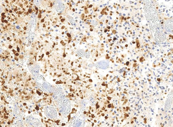 H3.3 G34R oncohistone mutant Antibody in Immunohistochemistry (IHC)