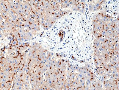 CD13 Antibody in Immunohistochemistry (Paraffin) (IHC (P))