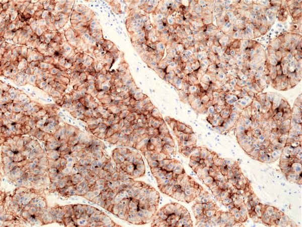 CD73 Antibody in Immunohistochemistry (Paraffin) (IHC (P))