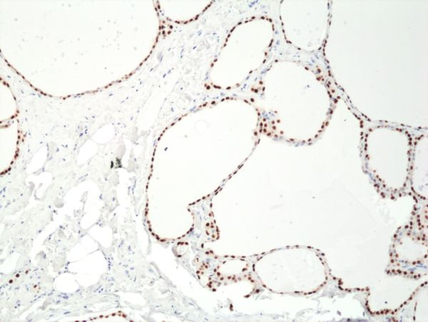 PAX8 Antibody in Immunohistochemistry (Paraffin) (IHC (P))