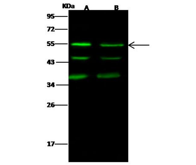 JNK2 Antibody in Western Blot (WB)