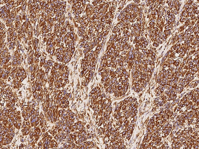 Vimentin Antibody in Immunohistochemistry (Paraffin) (IHC (P))