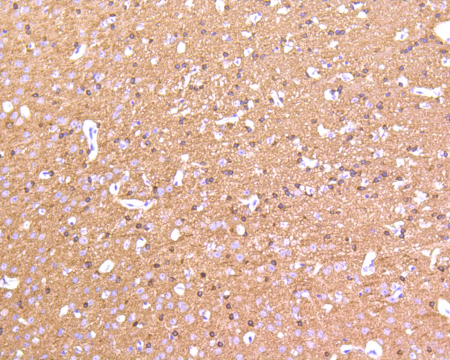 Tau Antibody in Immunohistochemistry (Paraffin) (IHC (P))