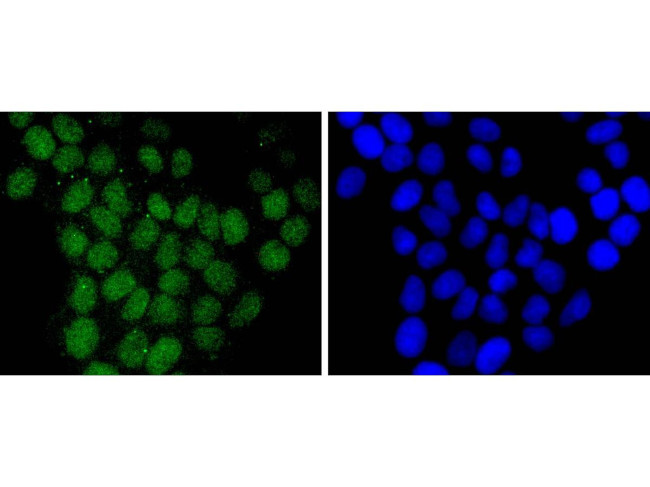 H2BR79me1 Antibody in Immunocytochemistry (ICC/IF)