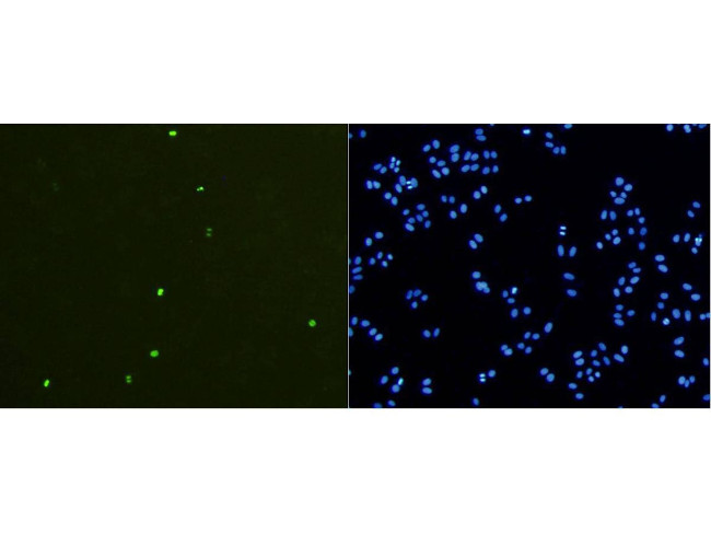 Phospho-Histone H3 (Ser10) Antibody in Immunocytochemistry (ICC/IF)