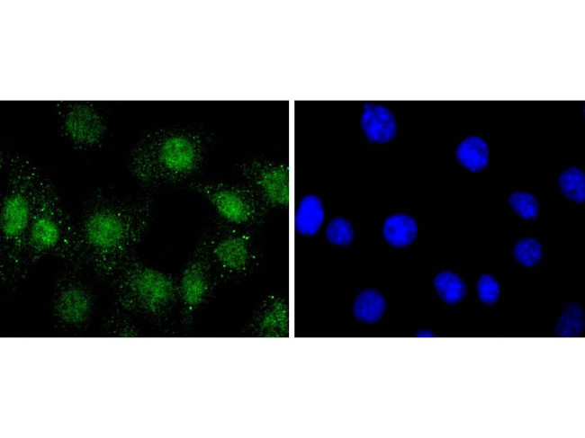 Phospho-AKT1 (Ser124) Antibody in Immunocytochemistry (ICC/IF)