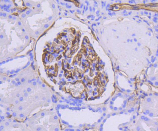 ICAM-1 Antibody in Immunohistochemistry (Paraffin) (IHC (P))