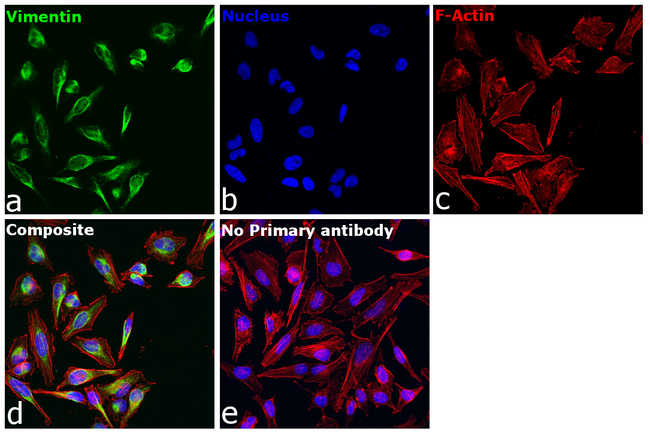 Vimentin Antibody in Immunocytochemistry (ICC/IF)