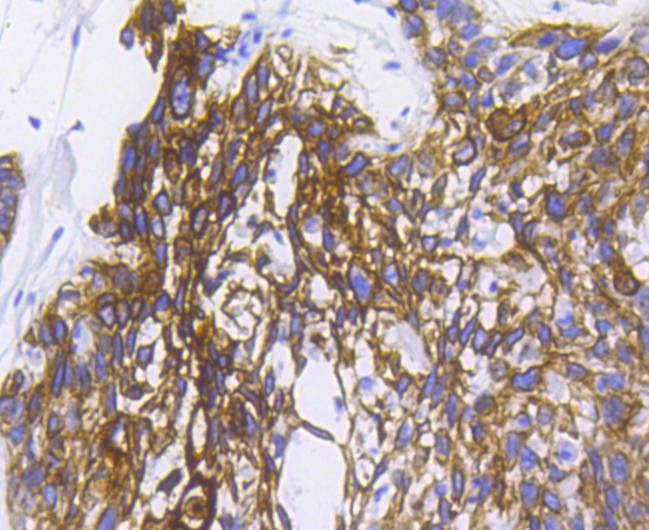 Cytokeratin 5 Antibody in Immunohistochemistry (Paraffin) (IHC (P))