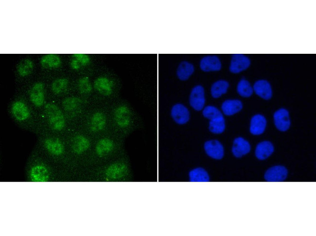 Phospho-SMAD3 (Ser423, Ser425) Antibody in Immunocytochemistry (ICC/IF)