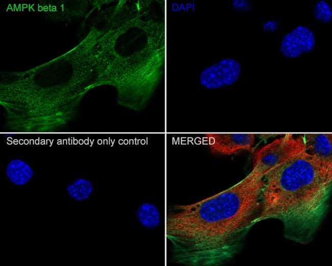 AMPK beta-1 Antibody in Immunocytochemistry (ICC/IF)