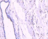 Phospho-AKT1 (Thr450) Antibody in Immunohistochemistry (Paraffin) (IHC (P))