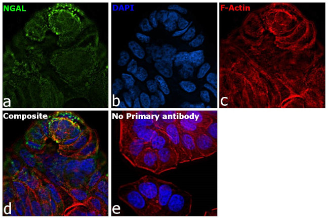 NGAL Antibody in Immunocytochemistry (ICC/IF)