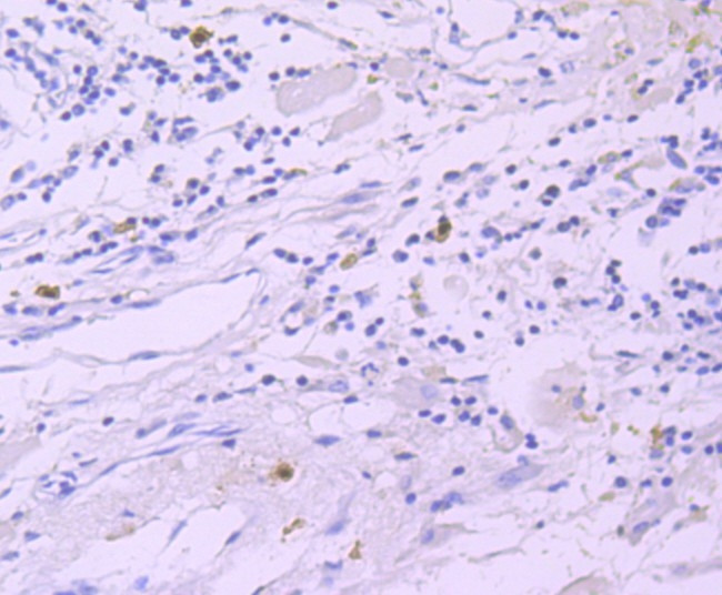 GATA1 Antibody in Immunohistochemistry (Paraffin) (IHC (P))