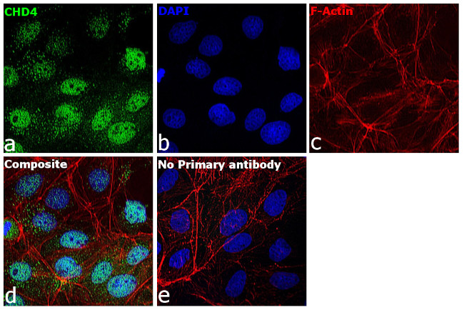 CHD4 Antibody in Immunocytochemistry (ICC/IF)