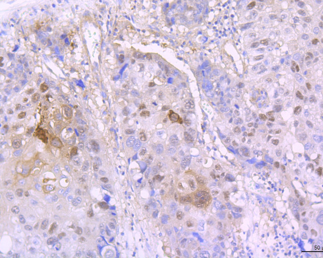 Involucrin Antibody in Immunohistochemistry (Paraffin) (IHC (P))