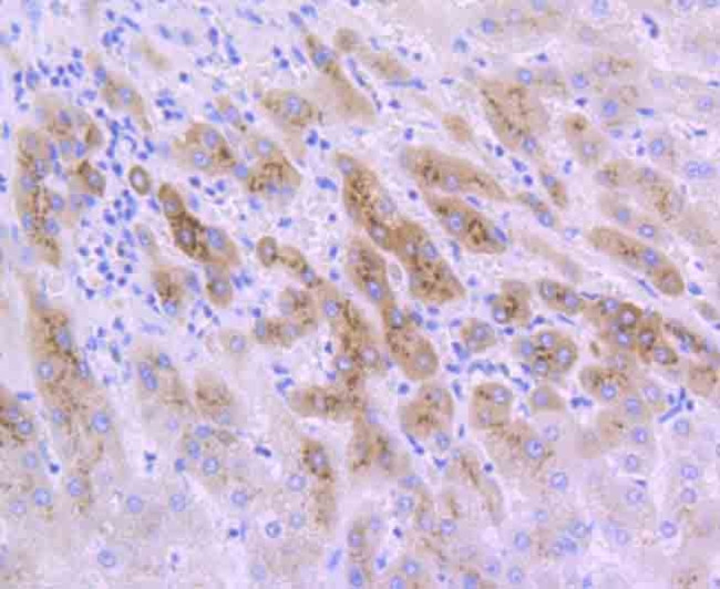 IGFBP2 Antibody in Immunohistochemistry (Paraffin) (IHC (P))