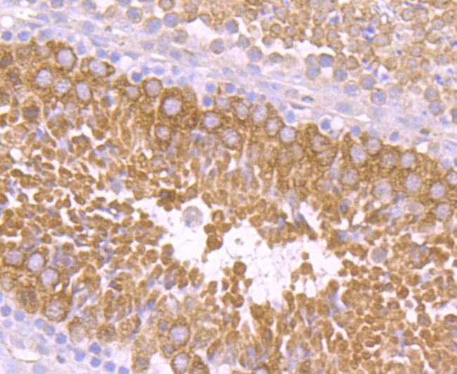 PIWIL1 Antibody in Immunohistochemistry (Paraffin) (IHC (P))