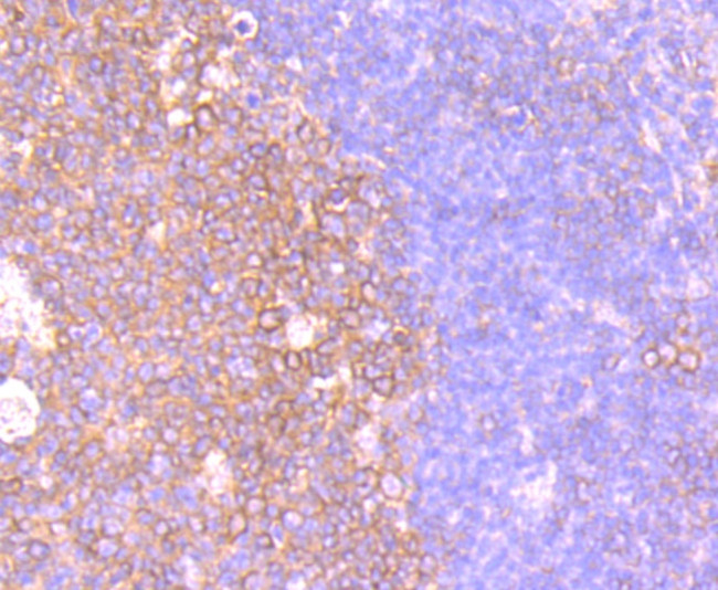 CXCR5 Antibody in Immunohistochemistry (Paraffin) (IHC (P))
